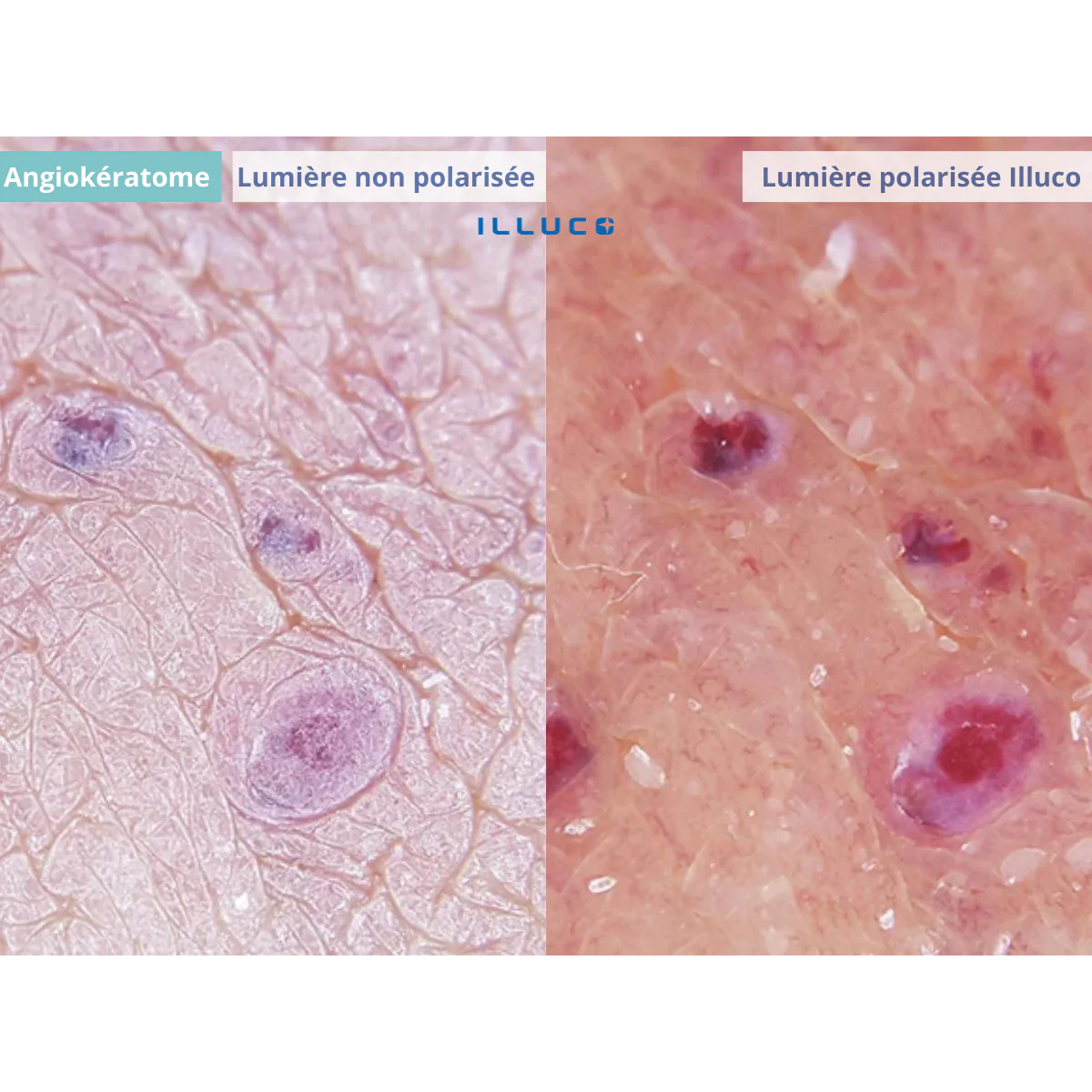 Dermatoscope rechargeable ILLUCO IDS-1100 - Image 8