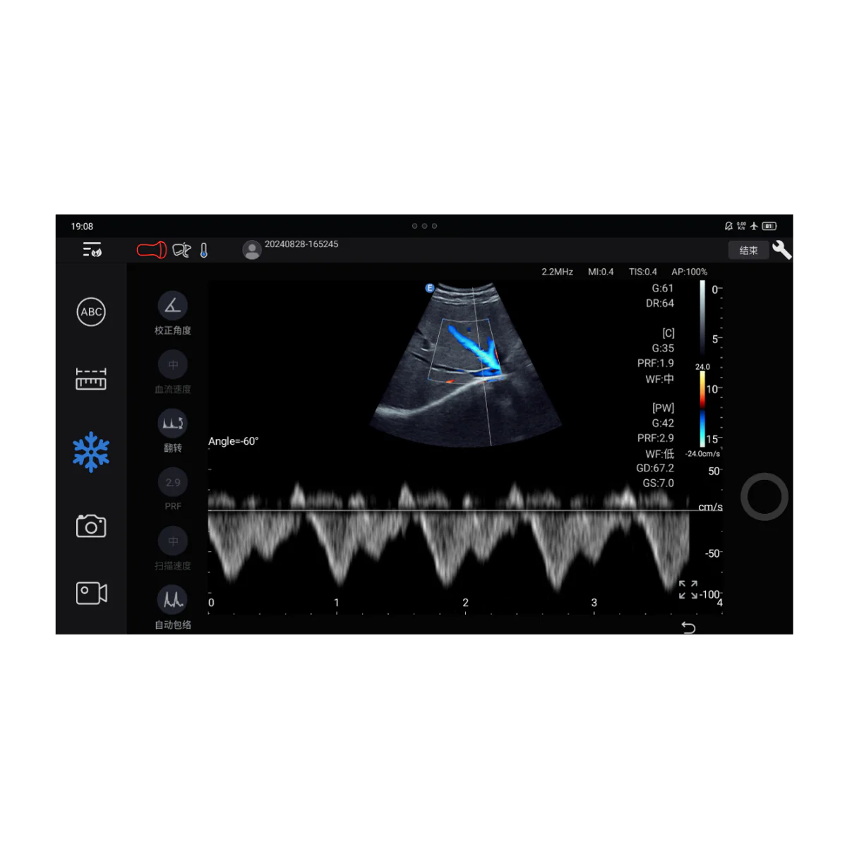 Echographe couleur portable Edan Nano convexe - Image 4