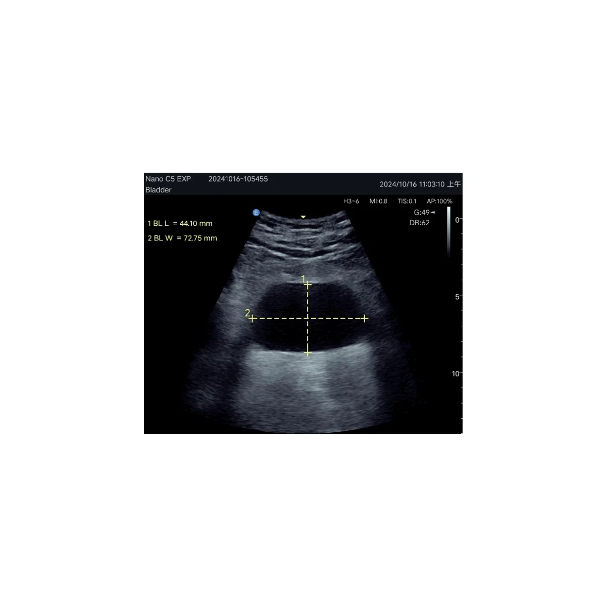 Echographe couleur portable Edan Nano convexe - Image 5