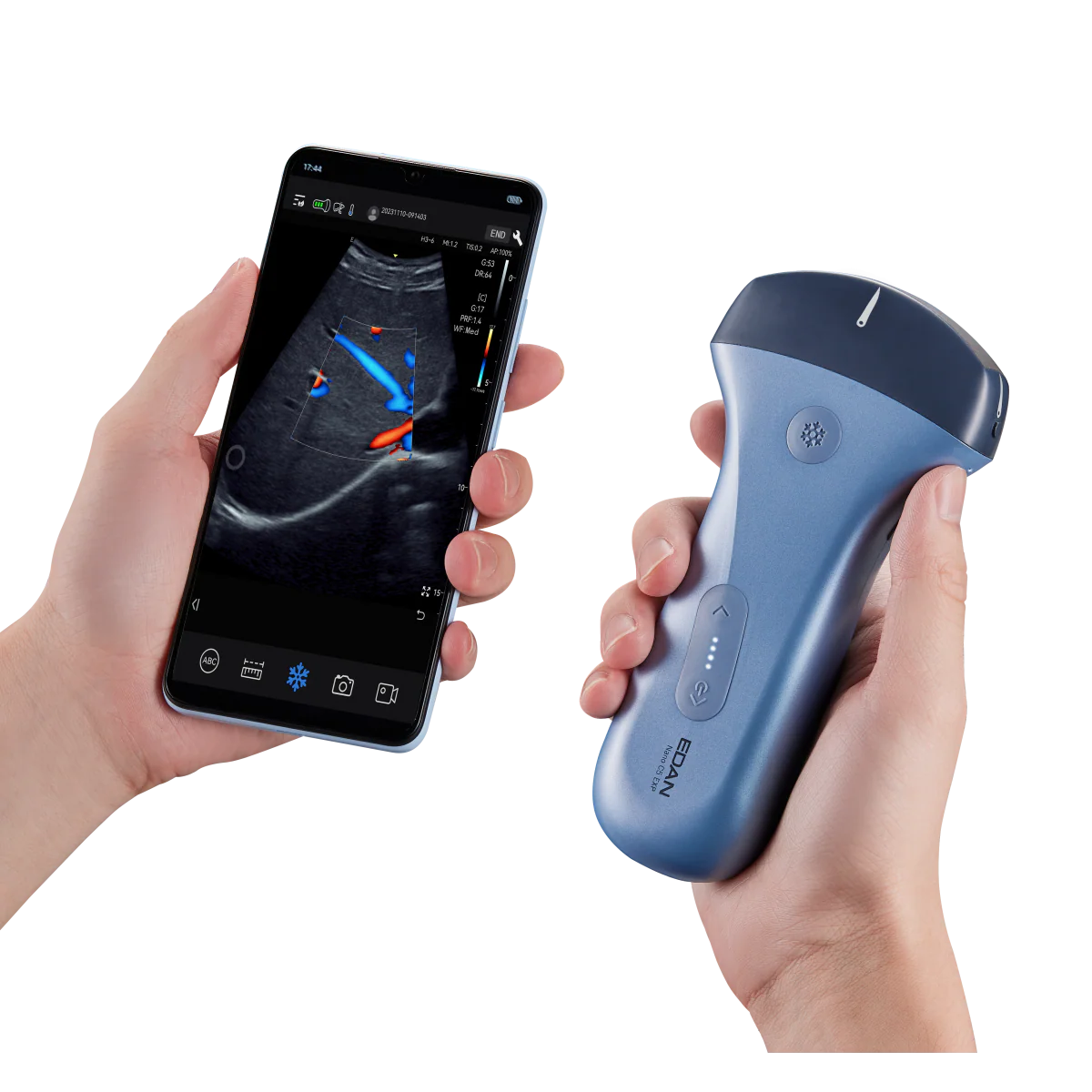 Echographe couleur portable Edan Nano convexe - Image 6